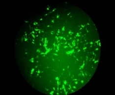 In Vitro Sonoporation Expression of Hela Cells