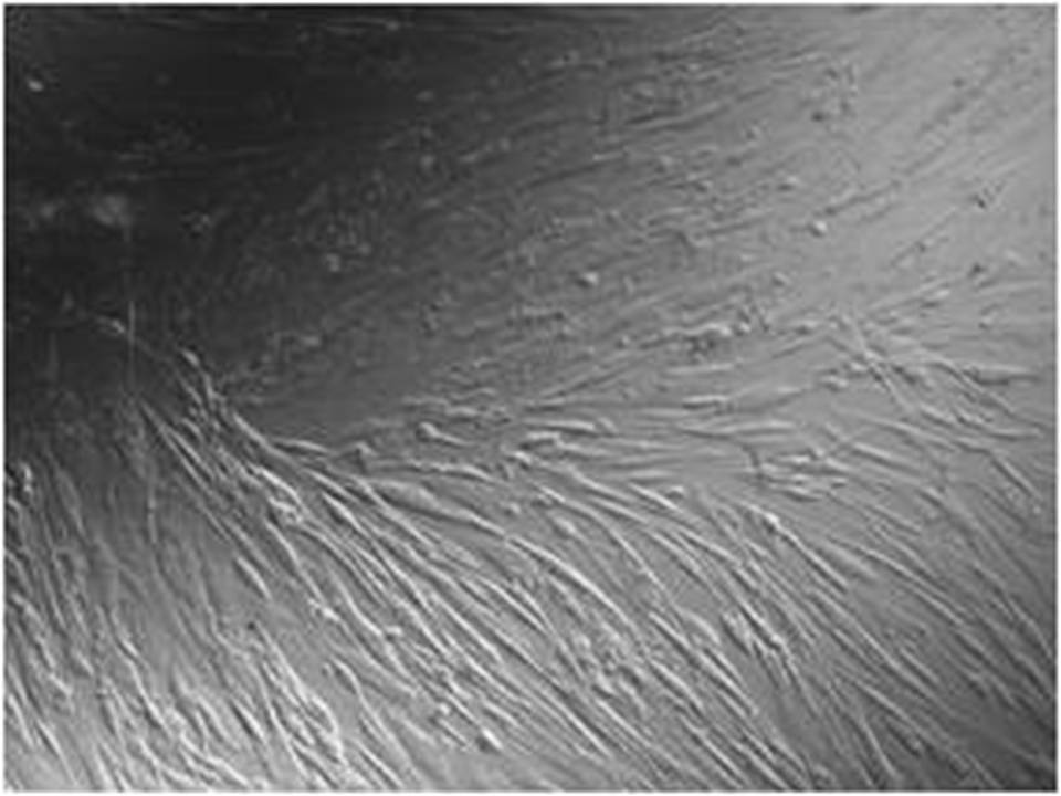 HASM Primary Human Airway Smooth Muscle cells-Viability90%