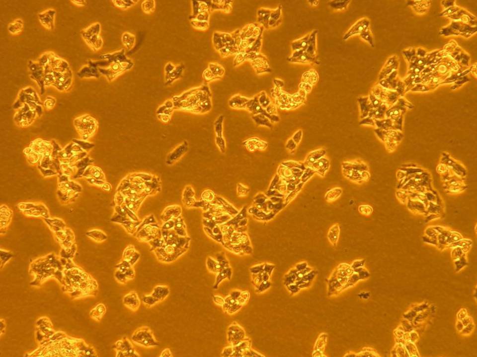 ANALYSING THE STAINING OF HUMAN HEPATOMA CELL LINES