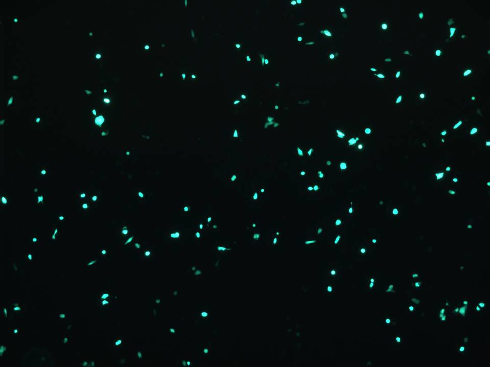 Mouse Pancreatic Islet Beta cells - Transfection Efficiency 40 per cent